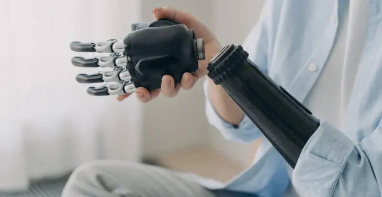 66472a8e835ab2b376ae13fa_understanding-shoulder-disarticulation-forequarter-prosthetics (1)