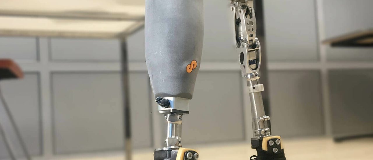forward-am-prothesis-prosfit-socket-in-use-header-uai-1440x1080